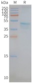 SDS-PAGE (CCR5-582H).jpg
